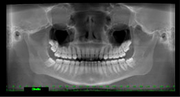 Ortodontia - foto 11