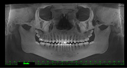Ortodontia - foto 12