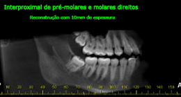 Ortodontia - foto 07