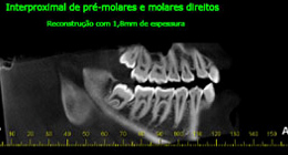 Ortodontia - foto 08